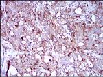 SCP3 Antibody in Immunohistochemistry (Paraffin) (IHC (P))