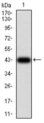 TCF4 Antibody in Western Blot (WB)