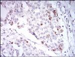 TRF2 Antibody in Immunohistochemistry (Paraffin) (IHC (P))