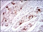 TRF2 Antibody in Immunohistochemistry (Paraffin) (IHC (P))