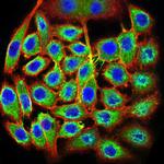 TTF1 Antibody in Immunocytochemistry (ICC/IF)