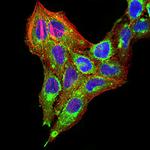 TTF1 Antibody in Immunocytochemistry (ICC/IF)