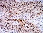 TTF1 Antibody in Immunohistochemistry (Paraffin) (IHC (P))