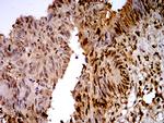 TTF1 Antibody in Immunohistochemistry (Paraffin) (IHC (P))