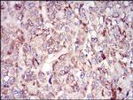 TUBE1 Antibody in Immunohistochemistry (Paraffin) (IHC (P))