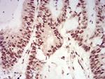 XRN2 Antibody in Immunohistochemistry (Paraffin) (IHC (P))