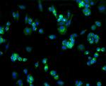 GLUT1 Antibody in Immunocytochemistry (ICC/IF)