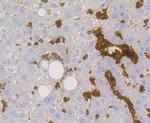 GLUT1 Antibody in Immunohistochemistry (Paraffin) (IHC (P))