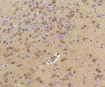 HSP70 Antibody in Immunohistochemistry (Paraffin) (IHC (P))