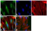 VCAM-1 (CD106) Antibody in Immunocytochemistry (ICC/IF)