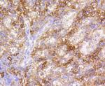 VCAM-1 (CD106) Antibody in Immunohistochemistry (Paraffin) (IHC (P))