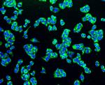 TSPO Antibody in Immunocytochemistry (ICC/IF)