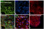 TSPO Antibody in Immunocytochemistry (ICC/IF)