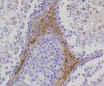 TSPO Antibody in Immunohistochemistry (Paraffin) (IHC (P))