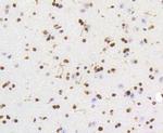 HMGB1 Antibody in Immunohistochemistry (Paraffin) (IHC (P))