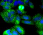 CD271 (NGF Receptor) Antibody in Immunocytochemistry (ICC/IF)