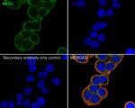 MLKL Antibody in Immunocytochemistry (ICC/IF)