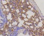 RPS3 Antibody in Immunohistochemistry (Paraffin) (IHC (P))