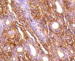 Filamin A Antibody in Immunohistochemistry (Paraffin) (IHC (P))