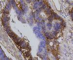 Integrin beta 1 (CD29) Antibody in Immunohistochemistry (Paraffin) (IHC (P))