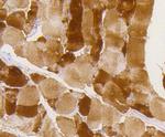 Phospho-GYS1 (Ser641) Antibody in Immunohistochemistry (Paraffin) (IHC (P))