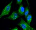 Cytokeratin 17 Antibody in Immunocytochemistry (ICC/IF)