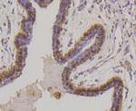 Cytokeratin 17 Antibody in Immunohistochemistry (Paraffin) (IHC (P))