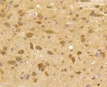 CDK5 Antibody in Immunohistochemistry (Paraffin) (IHC (P))