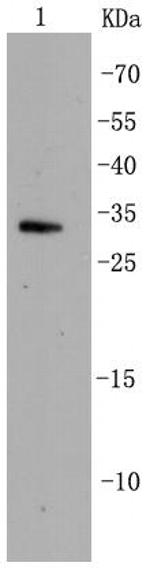 CDK5 Antibody in Western Blot (WB)