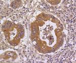 MKP3 Antibody in Immunohistochemistry (Paraffin) (IHC (P))