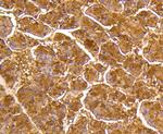 MKP3 Antibody in Immunohistochemistry (Paraffin) (IHC (P))