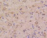 MKP3 Antibody in Immunohistochemistry (Paraffin) (IHC (P))