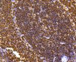 SHP-1 Antibody in Immunohistochemistry (Paraffin) (IHC (P))