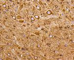 PI3K p55 gamma Antibody in Immunohistochemistry (Paraffin) (IHC (P))