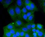 RAB9 Antibody in Immunocytochemistry (ICC/IF)