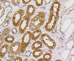 MEK1/MEK2 Antibody in Immunohistochemistry (Paraffin) (IHC (P))