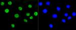 H2AK9ac Antibody in Immunocytochemistry (ICC/IF)