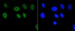 H2AK9ac Antibody in Immunocytochemistry (ICC/IF)