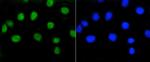 Phospho-Rb (Ser807) Antibody in Immunocytochemistry (ICC/IF)