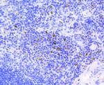 Phospho-Rb (Ser807) Antibody in Immunohistochemistry (Paraffin) (IHC (P))