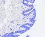 Phospho-Rb (Ser807) Antibody in Immunohistochemistry (Paraffin) (IHC (P))