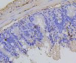 Phospho-Rb (Ser807) Antibody in Immunohistochemistry (Paraffin) (IHC (P))