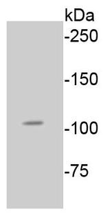 Phospho-Rb (Ser807) Antibody in Western Blot (WB)