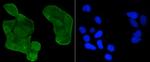 Acetyl-P53 (Lys370) Antibody in Immunocytochemistry (ICC/IF)