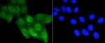 Acetyl-P53 (Lys370) Antibody in Immunocytochemistry (ICC/IF)