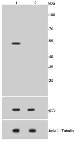 Acetyl-P53 (Lys370) Antibody in Western Blot (WB)