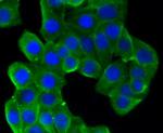 beta-5 Tubulin Antibody in Immunocytochemistry (ICC/IF)