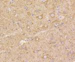 beta-5 Tubulin Antibody in Immunohistochemistry (Paraffin) (IHC (P))