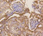 beta-5 Tubulin Antibody in Immunohistochemistry (Paraffin) (IHC (P))