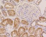 beta-5 Tubulin Antibody in Immunohistochemistry (Paraffin) (IHC (P))